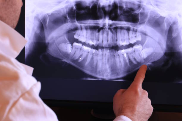 Best Weekend Emergency Dentist in Charles City, IA