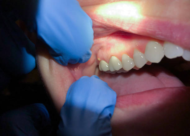 Best Pediatric Emergency Dentist in Charles City, IA