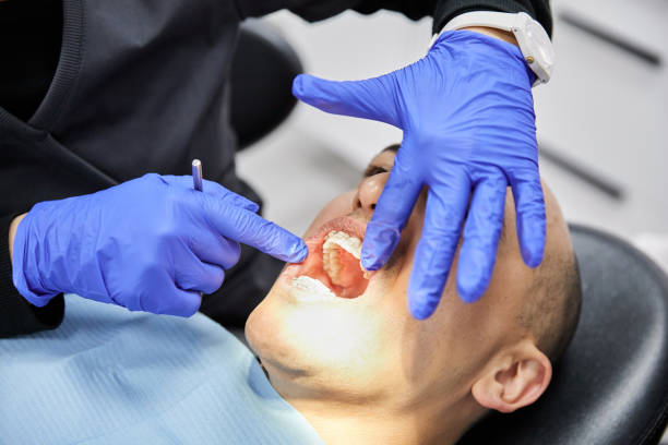 Best Urgent Dental Care for Toothache in Charles City, IA